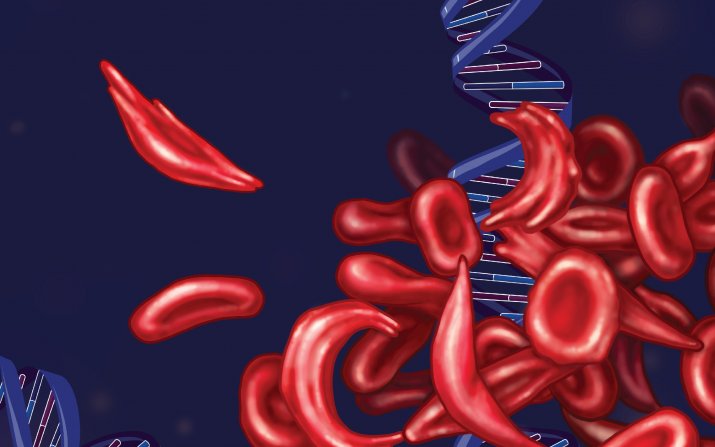Illustration of sickle cell disease DNA