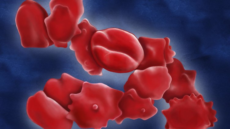 Illustration of mercury exposure on red blood cells