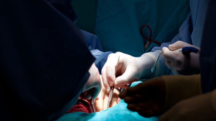 surgeon's hands performing heart surgery