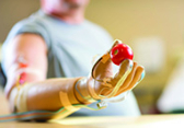 prosthetic hand
